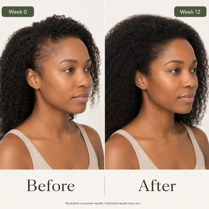 Root Revive Scalp Care Serum