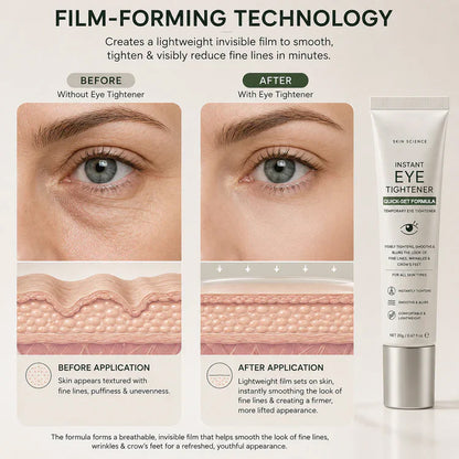 ⏰Last Day-Buy 1 Get 1 Free🔥 𝐈𝐧𝐬𝐭𝐚𝐧𝐭 𝐄𝐲𝐞 𝐓𝐢𝐠𝐡𝐭𝐞𝐧𝐞𝐫 | Smooth & Firm Under Eyes